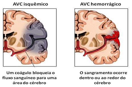 Quais São as Causas dos Dois?