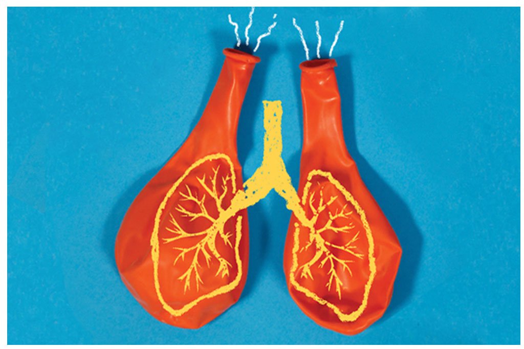 O Que é Bronquiolite e Pneumonia?