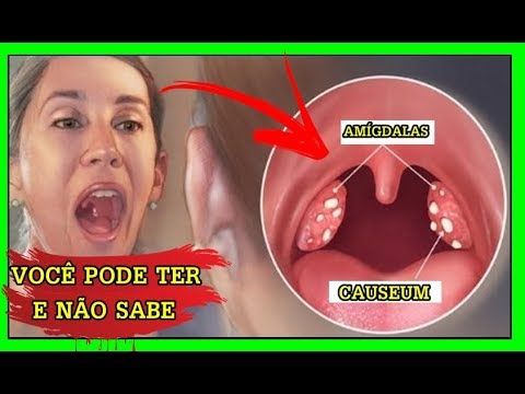 Utilize produtos para refrescar sua boca