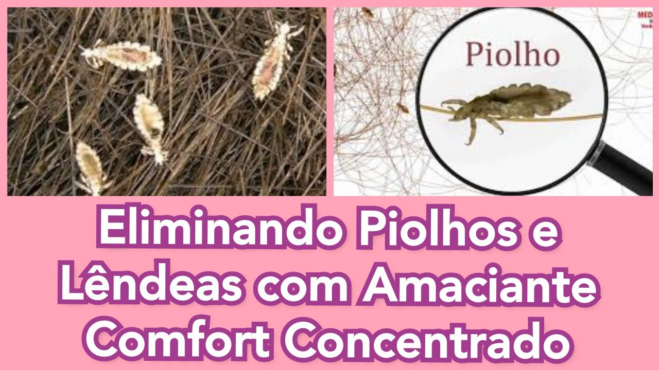 Elimine os Piolhos com Amaciante: Uma Solução Rápida e Fácil