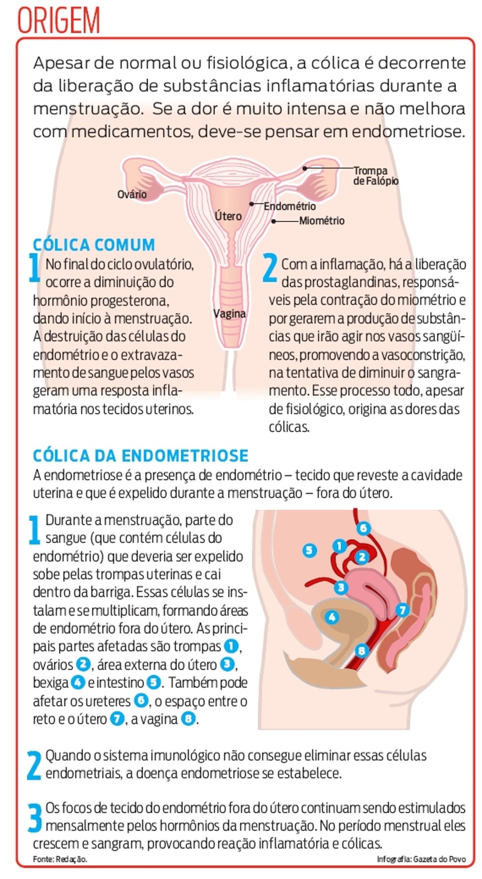 O Que Causa a Cólica?