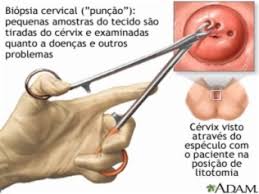 Quais São os Principais Fatores de Risco para Desenvolver uma Mancha no Colo do Útero?