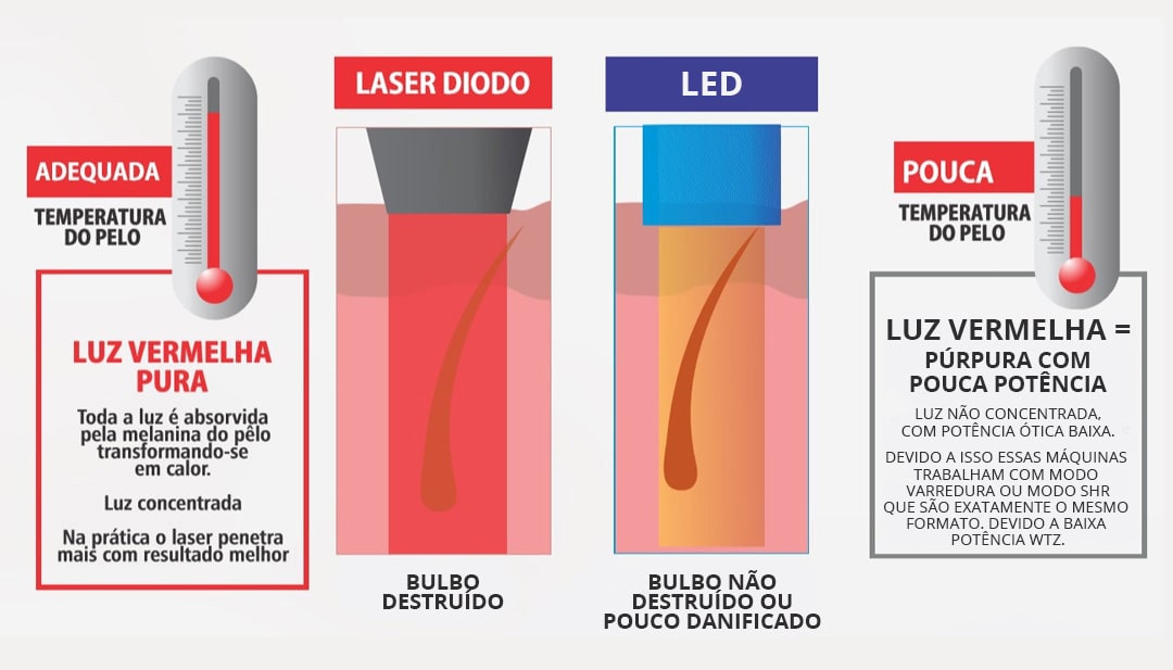 O Que é Depilação a Laser e LED?