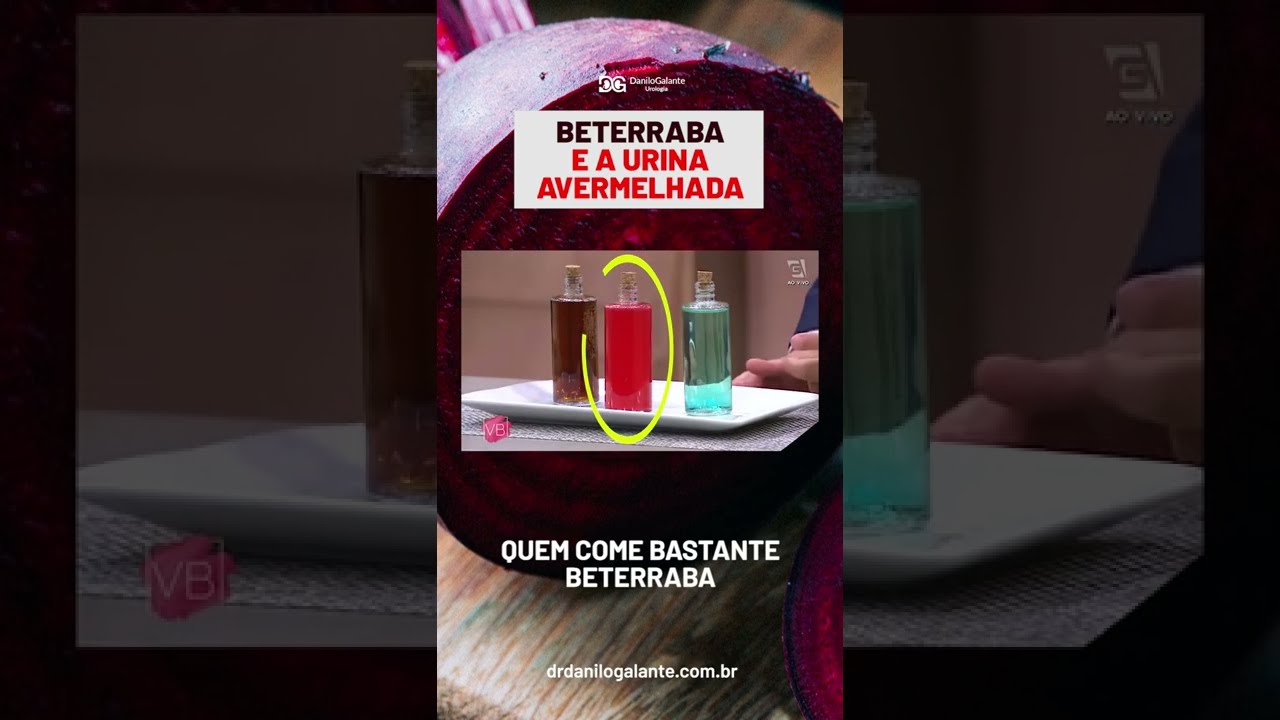 Por que a urina pode sair vermelha após comer beterraba?