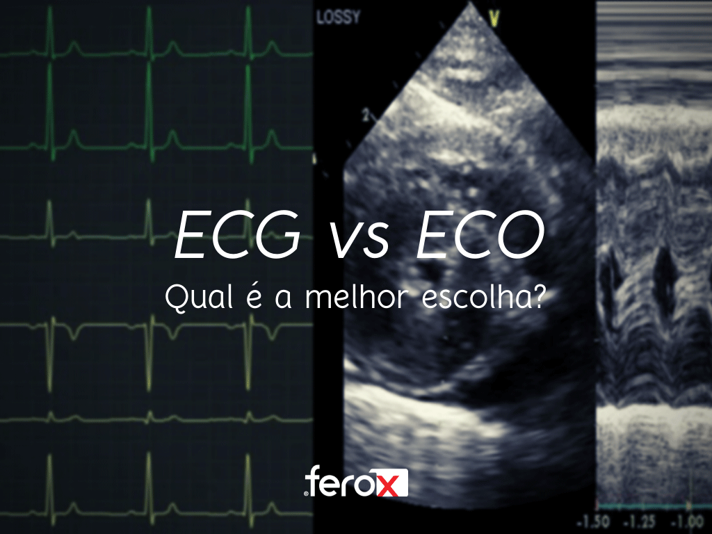 O Que É um ECG e um Ecocardiograma?