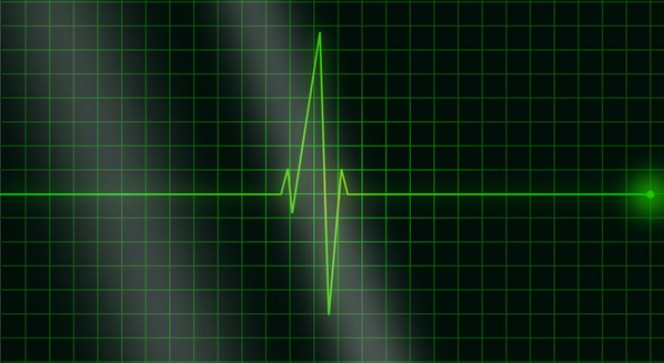 Como Os Resultados do ECG e do Ecocardiograma São Interpretados?