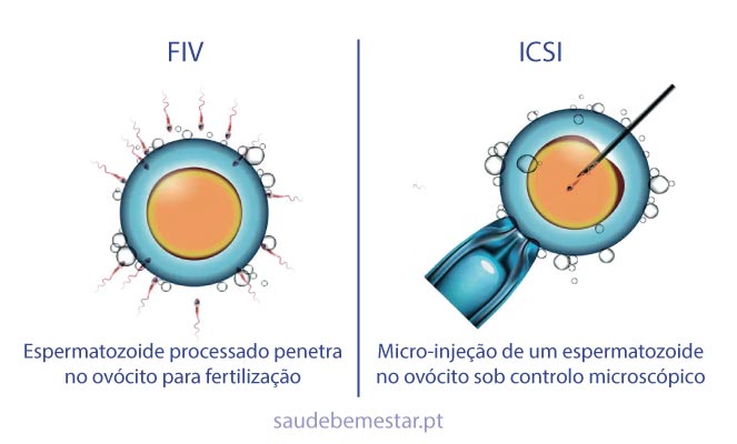 Quais Riscos Estão Associados às Duas Técnicas de Reprodução Assistida?