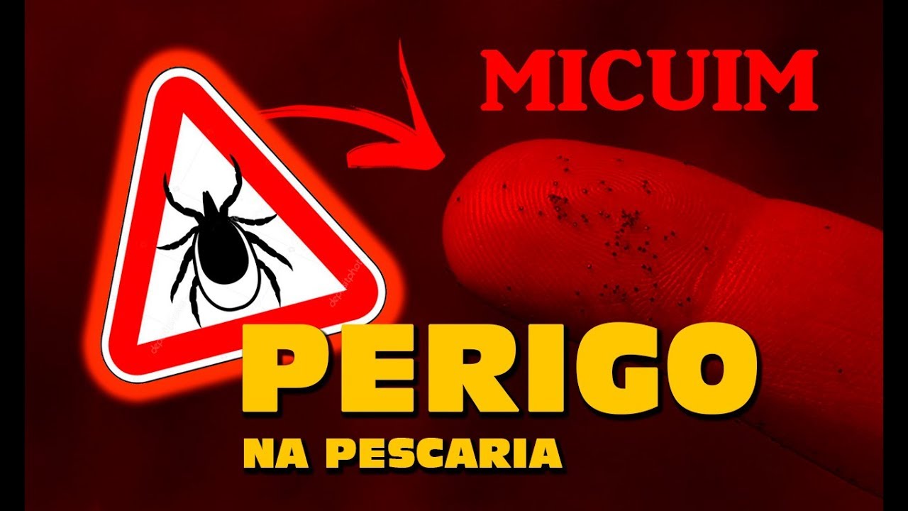 Dicas e Truques Para Se Livrar do Micuim