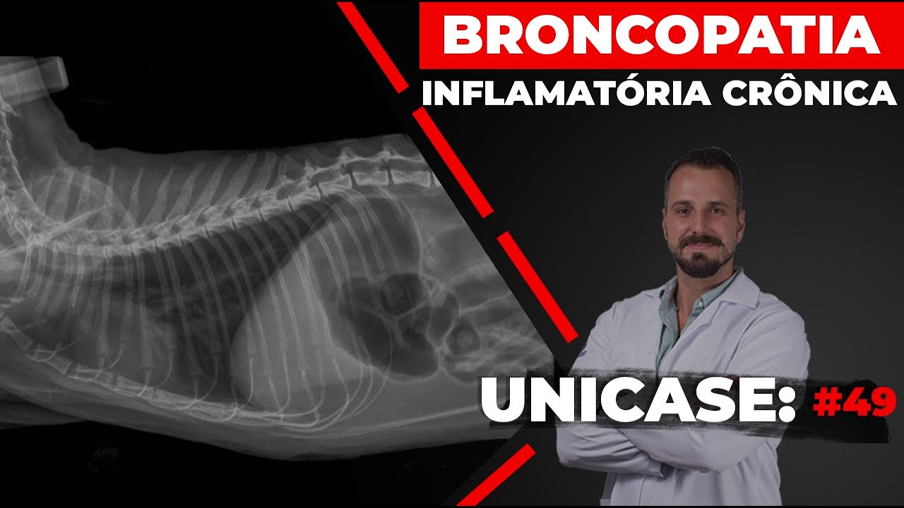 Sintomas e Causas da Broncopatia Inflamatória