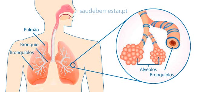 Tratamento para a Broncopatia Inflamatória