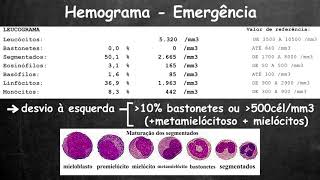 Como Identificar e Tratar a Anemia por Deficiência de Ferro?