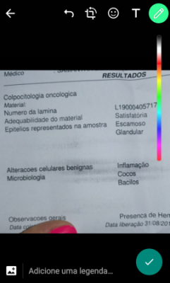 O que São Cocos e Bacilos?