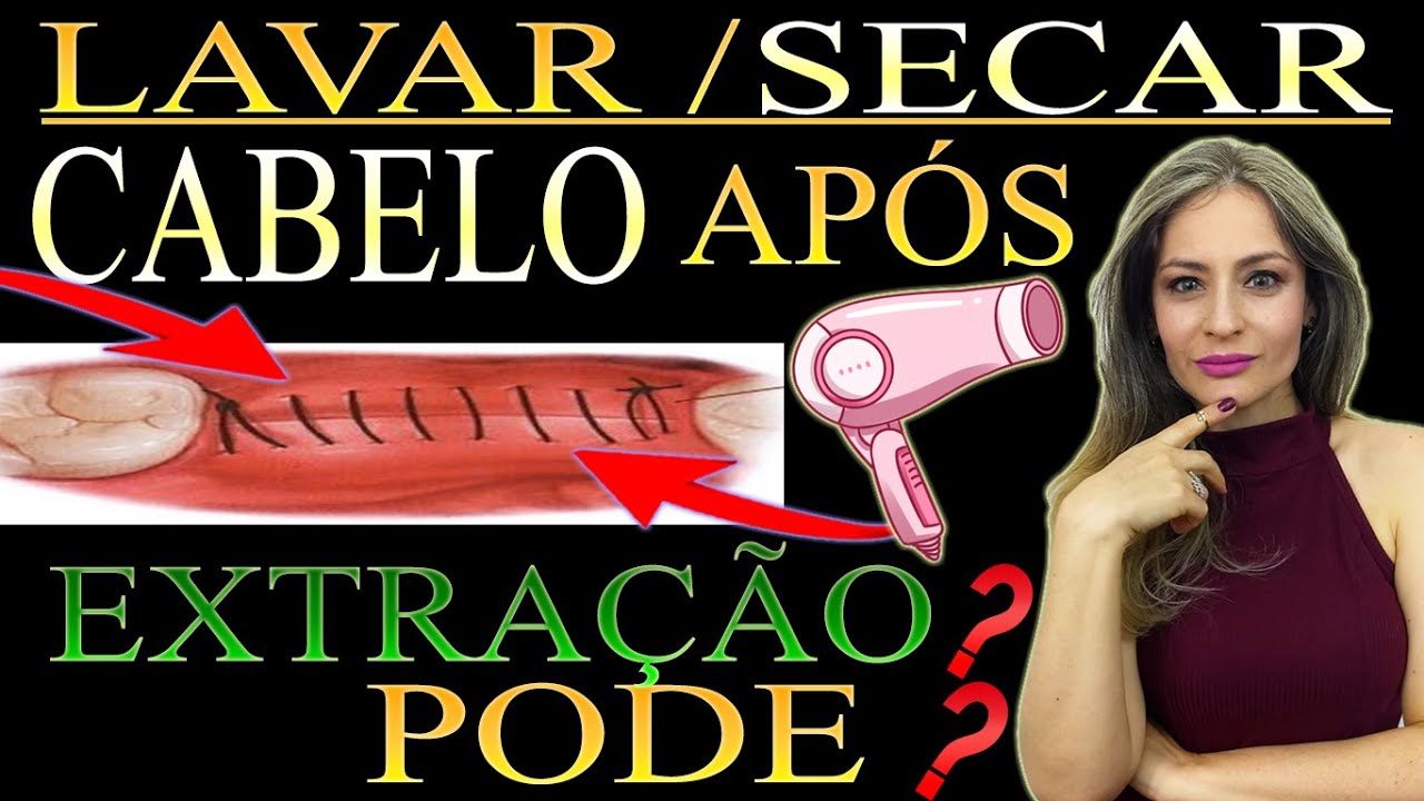 O Que Fazer Após Extrair um Dente?