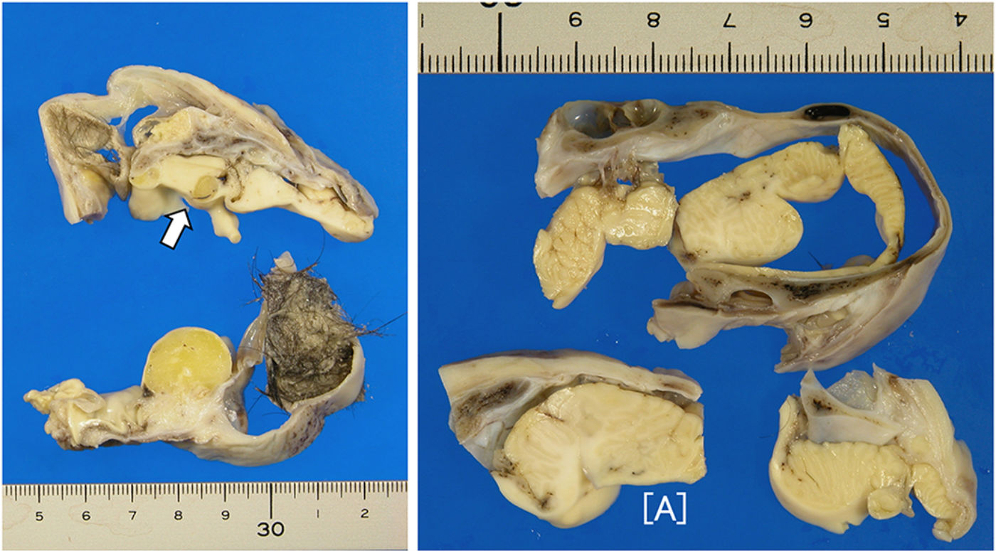 Entendendo o Significado Evolutivo da Presença de Cabelo e Dentes em Mioma