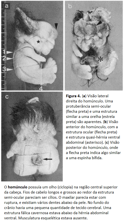 Porque Alguns Animais Possuem Cabelo e Dentes, Enquanto Outros Não?