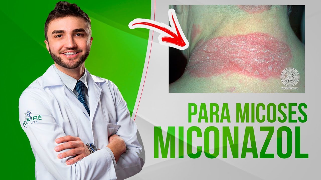 Prevenindo e Mitigando os Riscos da Queima do Nitrato de Miconazol