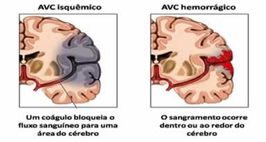 Qual o Tratamento Recomendado para Cada Condição?