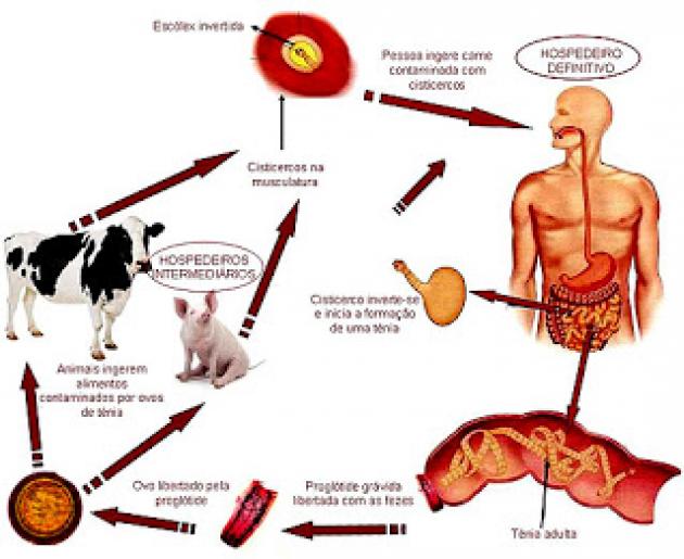 Como a Teniase e a Cisticercose Se Manifestam?