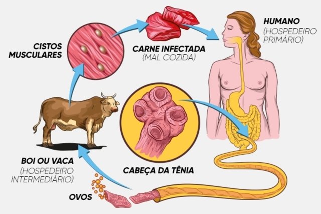 Quais os Tratamentos para Teniase e Cisticercose?