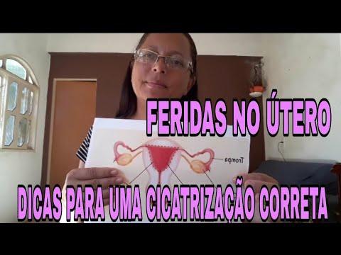 Benefícios de Usar Tratamentos Caseiros Para Feridas no Útero