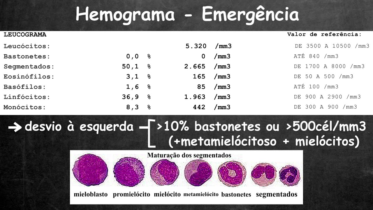 O Que Significa Quando a Segmentação Está Alta?