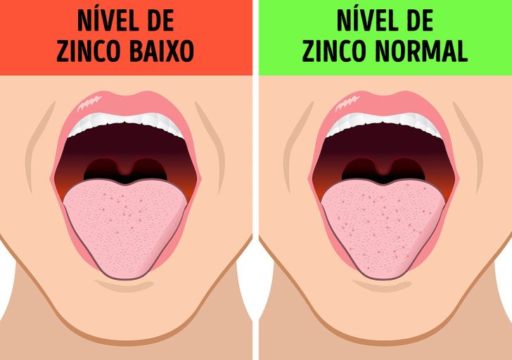 Como Tratar a Saliva Adocicada?