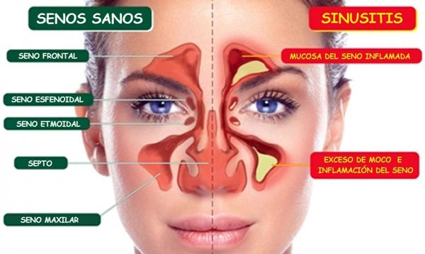 Como Tratar as Doenças de Forma Eficaz?